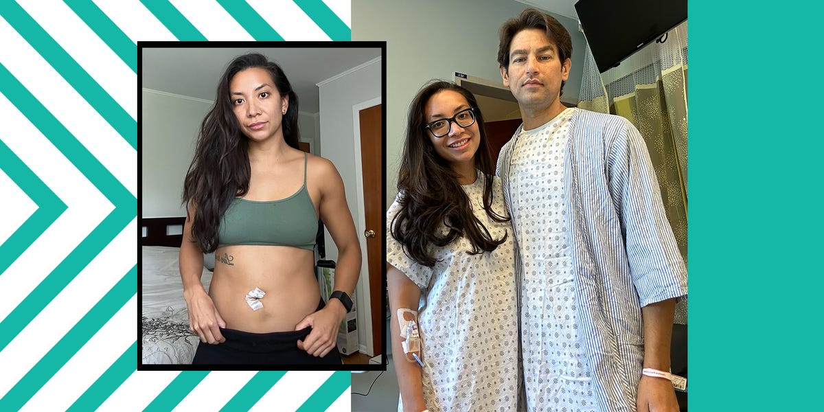 Woman Donates Kidney to Fiancé, Now Expecting First Baby