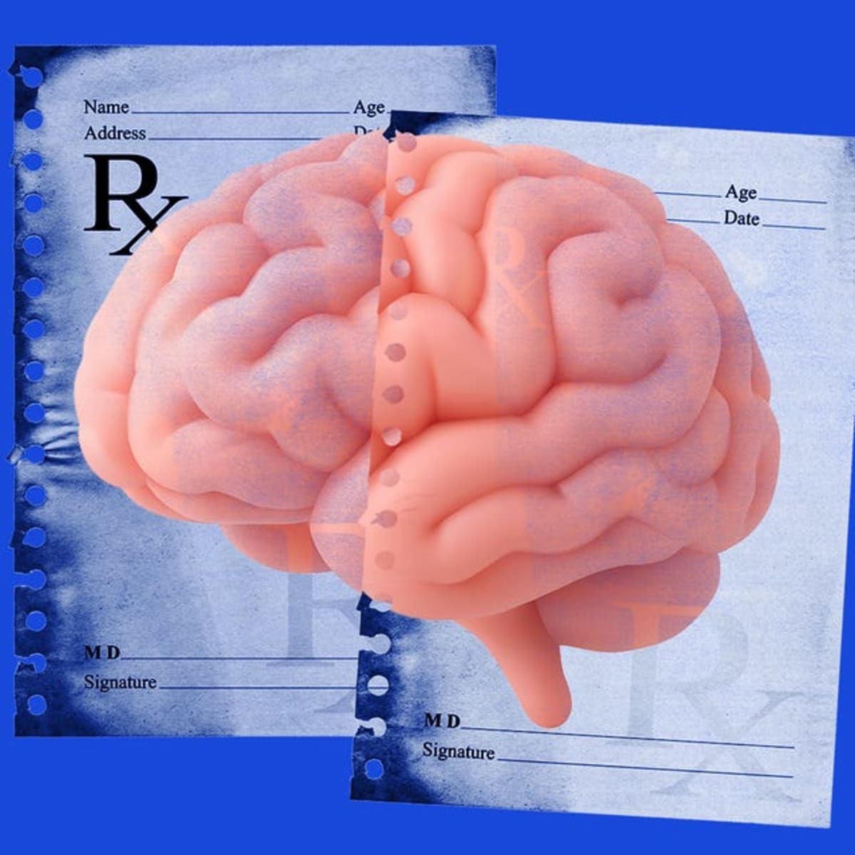Statins Lower Dementia Risk 15% in Diabetes Patients - Image 3