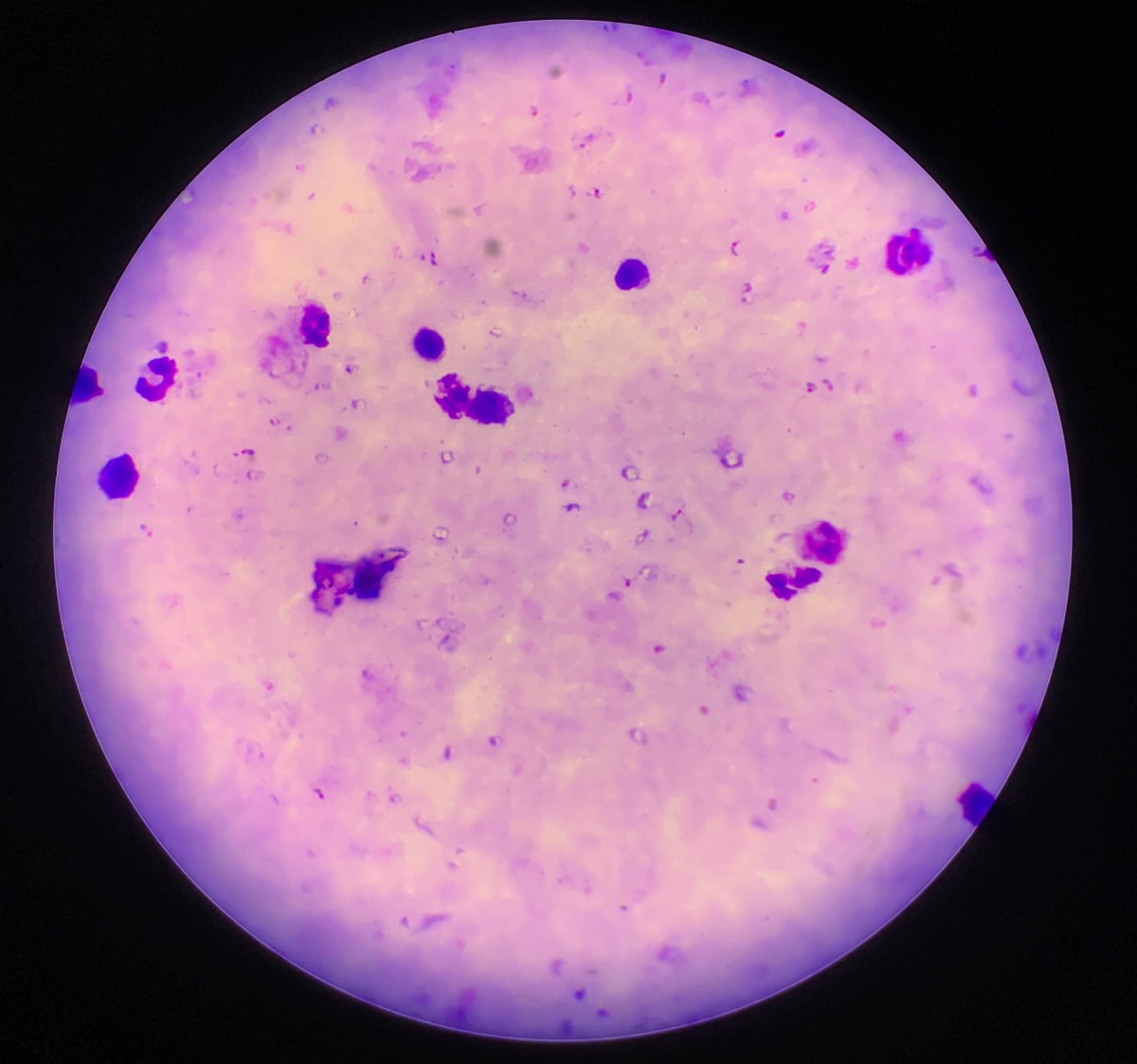 Harvard Finds New Clue to Malaria Drug Resistance - Image 2