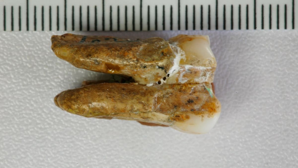 Ancient Teeth Reveal New Clues About Human Evolution
