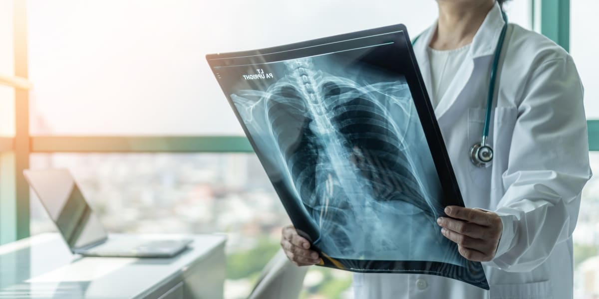 New COPD Drug Reduces Flare-Ups by 34% in Smokers - Image 2
