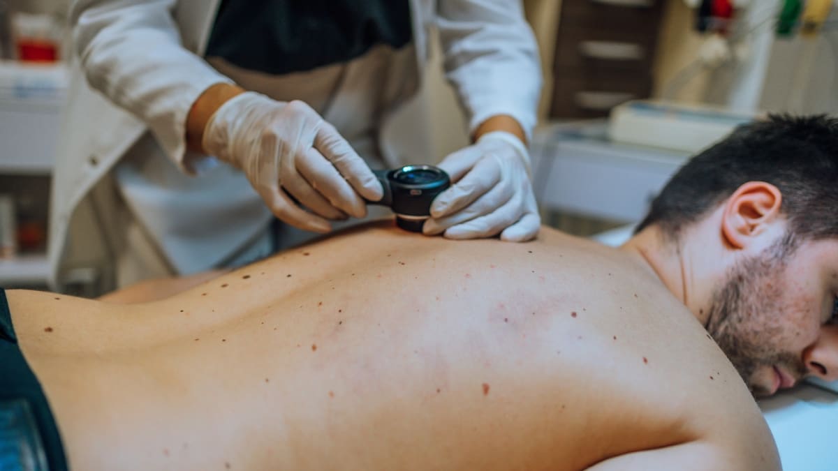 Medical professional examining patient's skin for melanoma in clinical setting