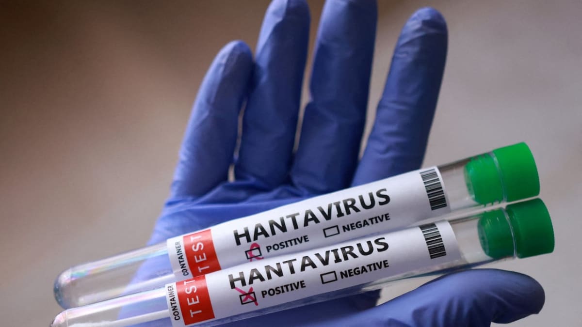 Scientists Race Toward First Hantavirus Vaccine - Image 3