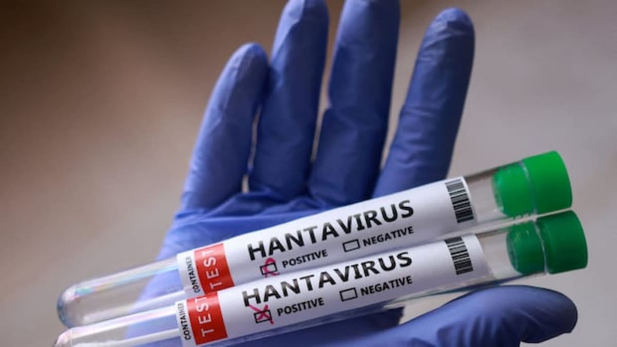** Scientist in laboratory working on vaccine development with research equipment and samples