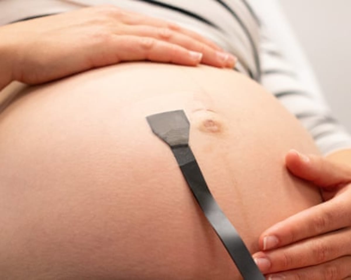 Wearable Ultrasound Patch Monitors Babies in the Womb 24/7 - Image 3
