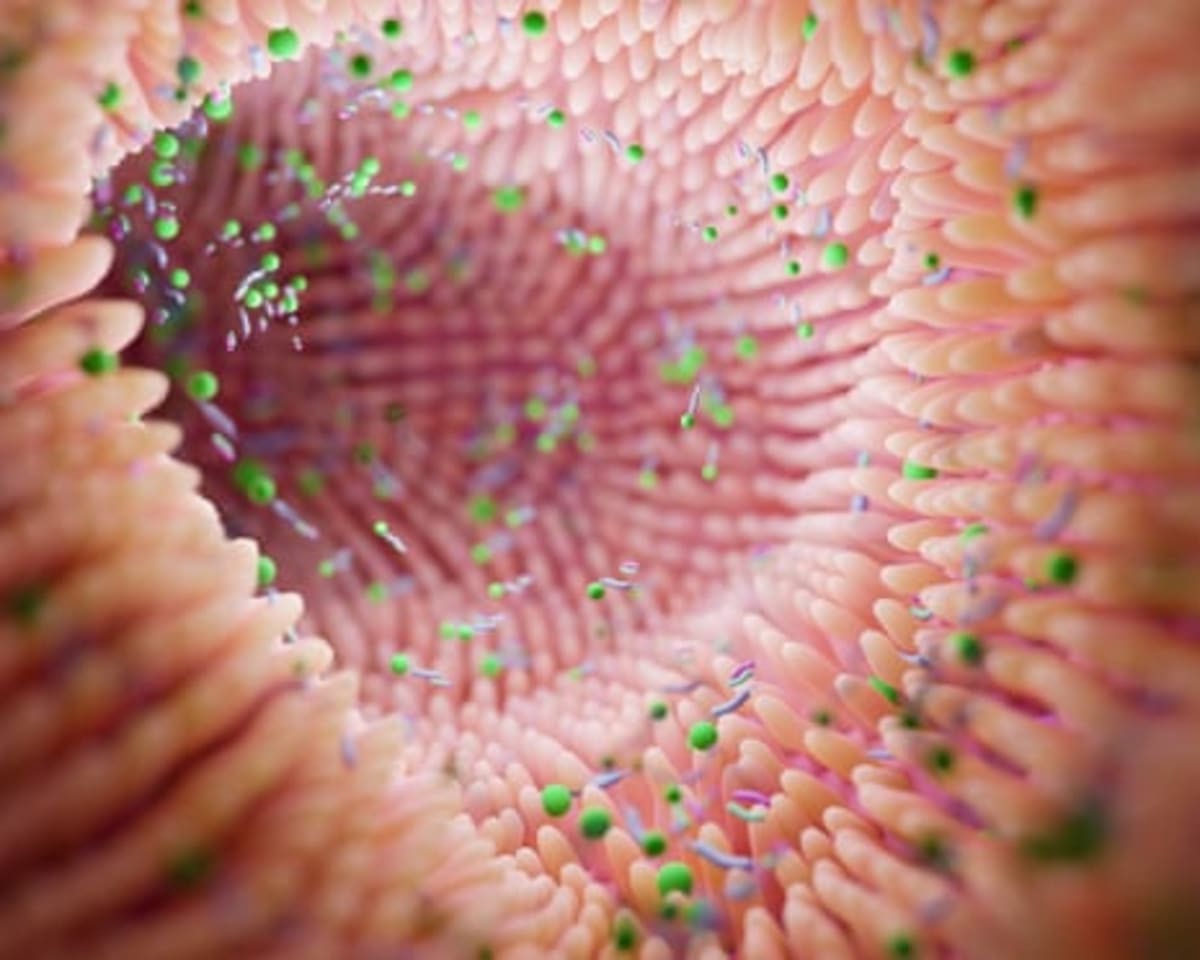 Gut Test Could Spot Parkinson's Years Before Symptoms - Image 3