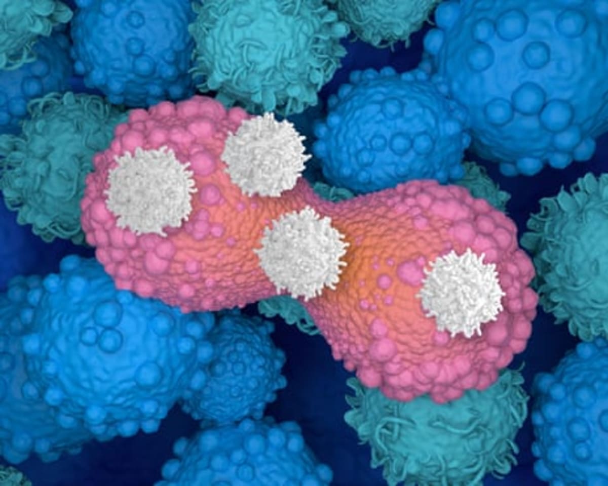 CAR T-Cell Therapy Brings Cancer Hope After Sam Neill Cure - Image 3