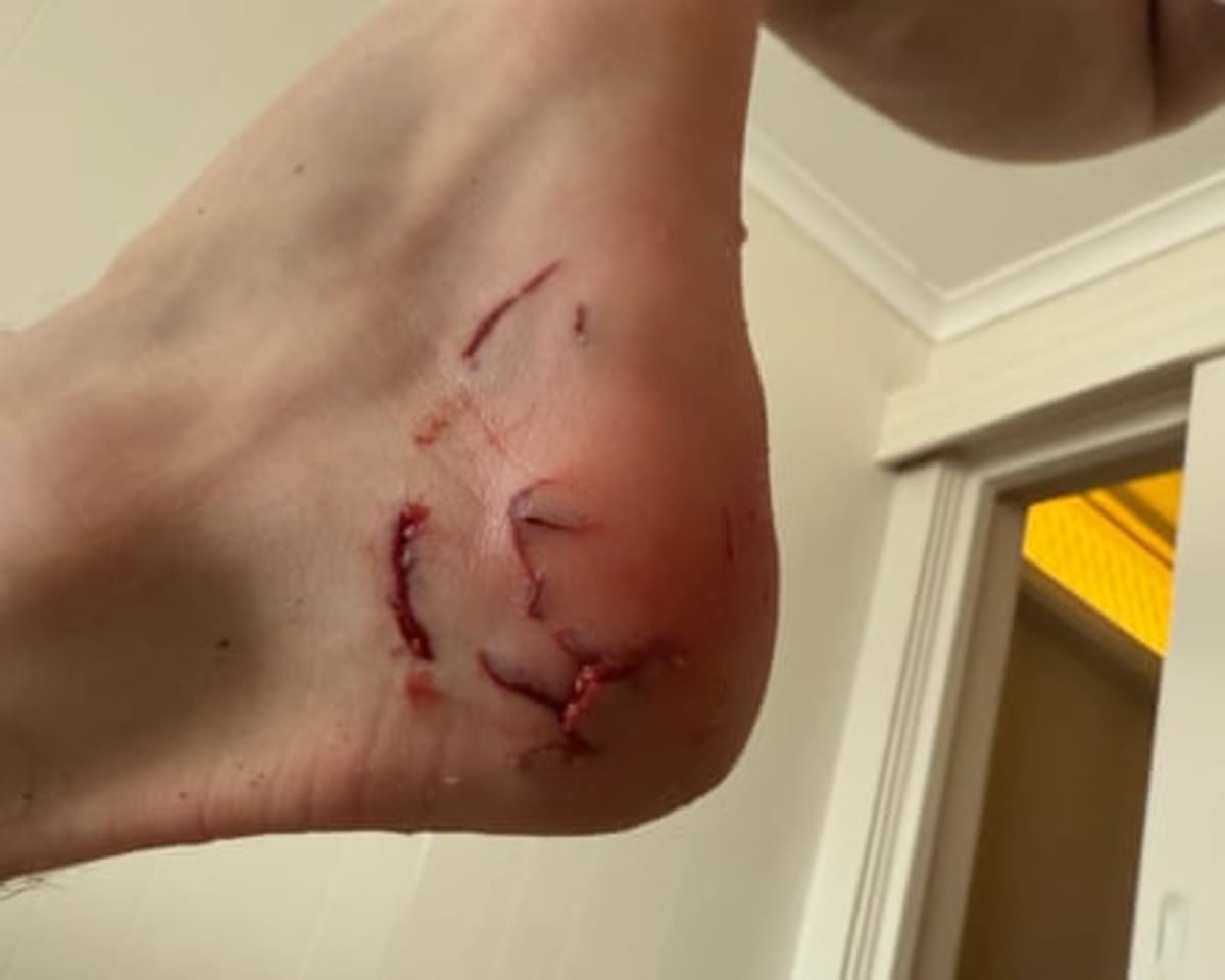 Teen Surfer Flicks Off Shark, Rides Wave Back to Shore - Image 4