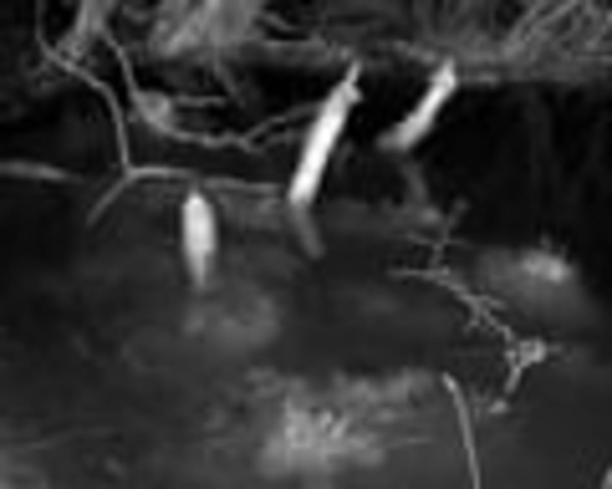 Beavers Build 35-Meter Dam, Transform Dorset Wildlife - Image 3