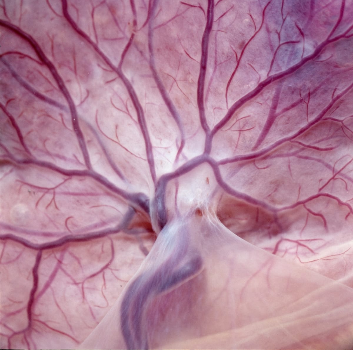 Scientists Find Gene Behind Preeclampsia Deaths - Image 4