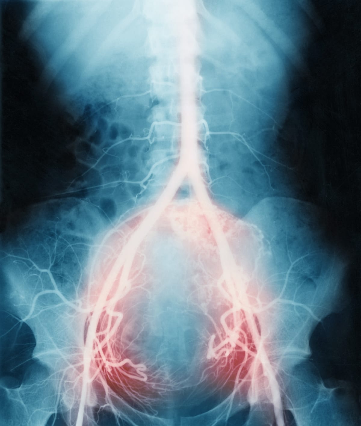 Scientists Find Gene Behind Preeclampsia Deaths - Image 3
