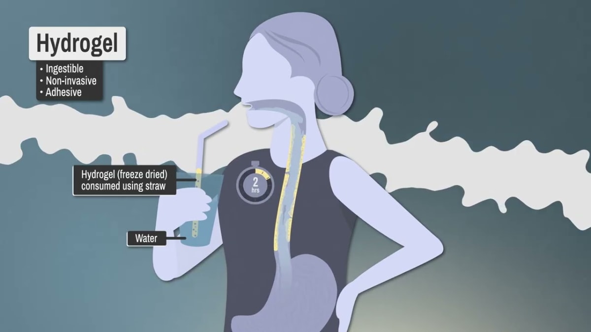 MIT Creates Gel That Delivers Drugs to the Esophagus - Image 2