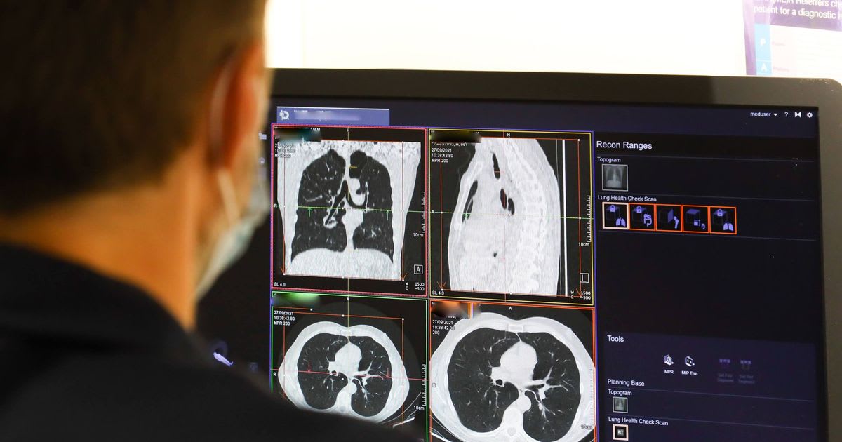 AI Detects Pancreatic Cancer 16 Months Before Doctors - Image 2