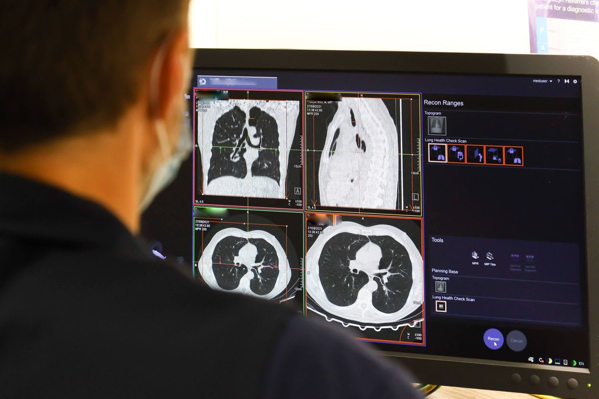 AI Detects Pancreatic Cancer 16 Months Before Doctors - Image 3
