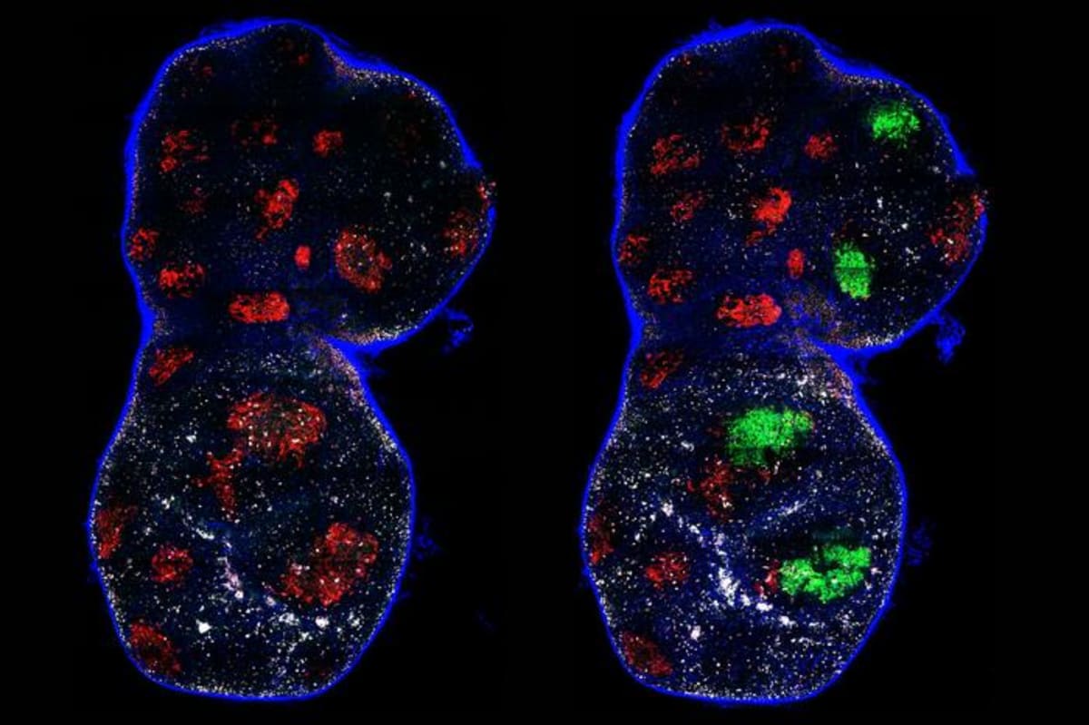 New Partnership Tackles Brain Drug Delivery Challenge - Image 5