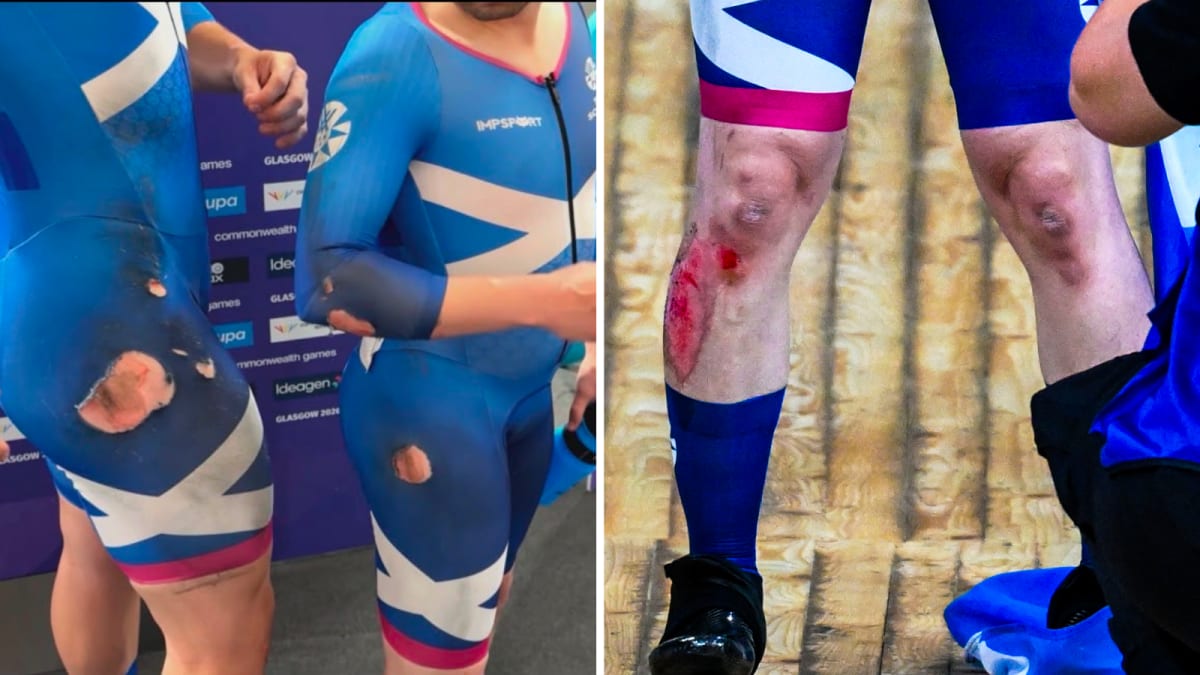 Scottish Cyclist Wins Gold After Dramatic Crash in Final Race - Image 3