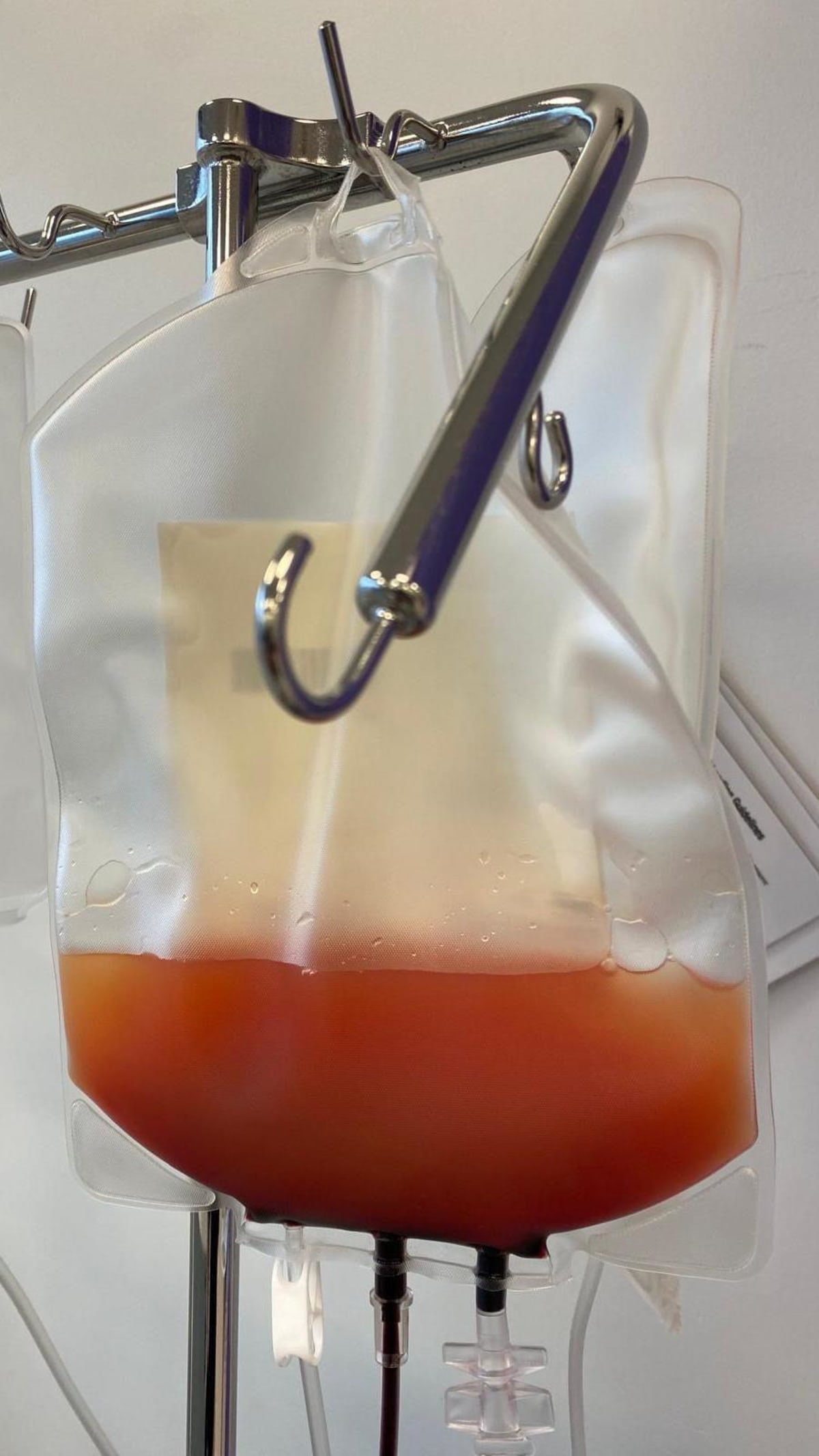 Experimental Immune Reset Puts Lupus Into Remission - Image 5