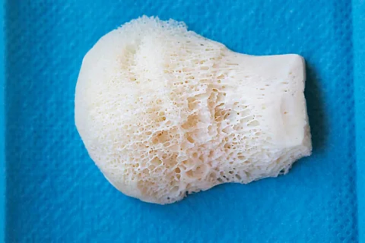 AI Designs Hip Implants That Last Longer Than Ever - Image 5