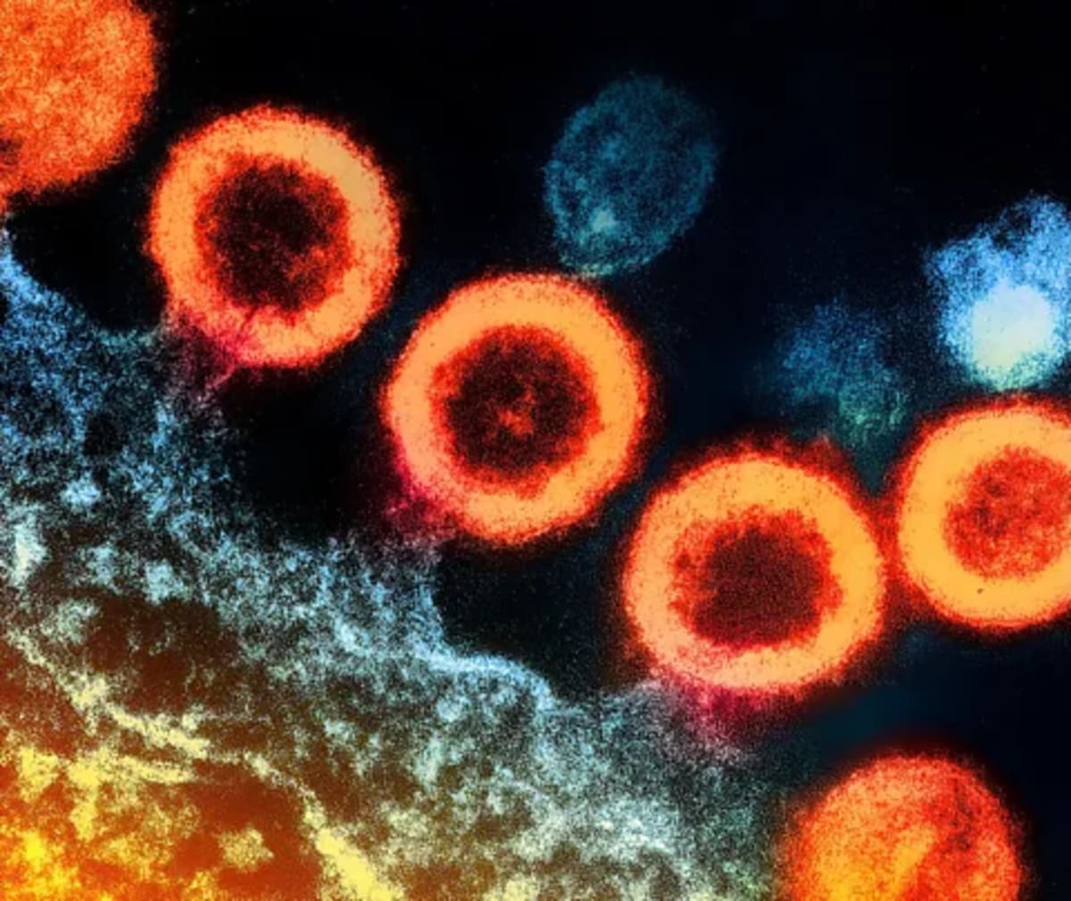 Scientists Find Hope for HIV Cure in Elite Controllers - Image 4