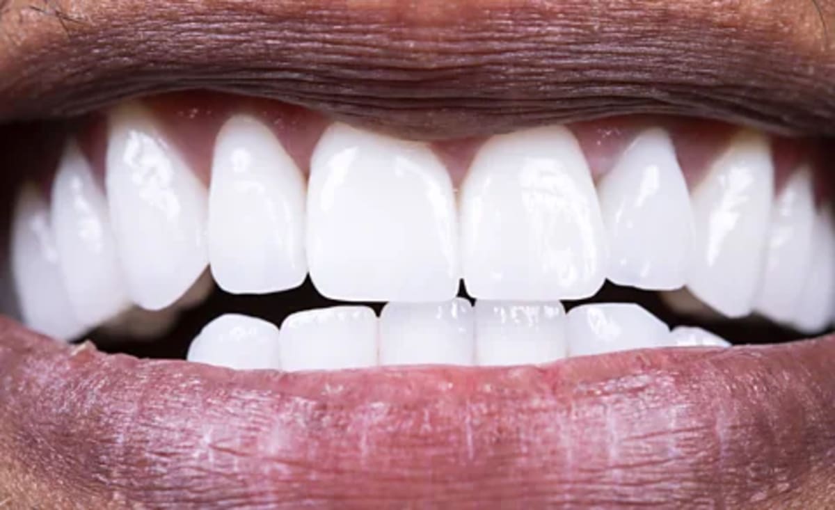 Your Mouth Bacteria Could Save Your Heart - Image 2