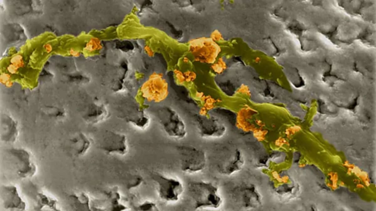 Your Mouth Bacteria Could Save Your Heart - Image 3