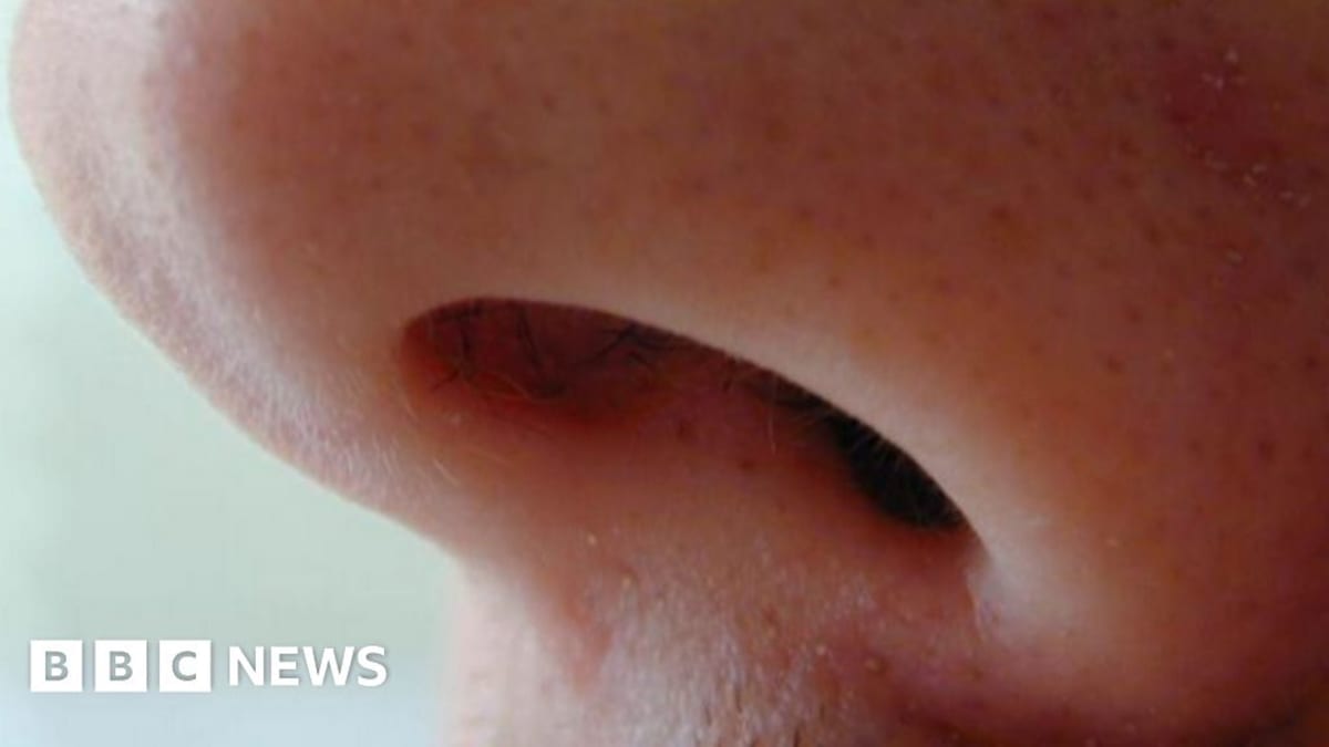 Medical professional preparing injectable Dupilumab treatment for patient with chronic nasal condition