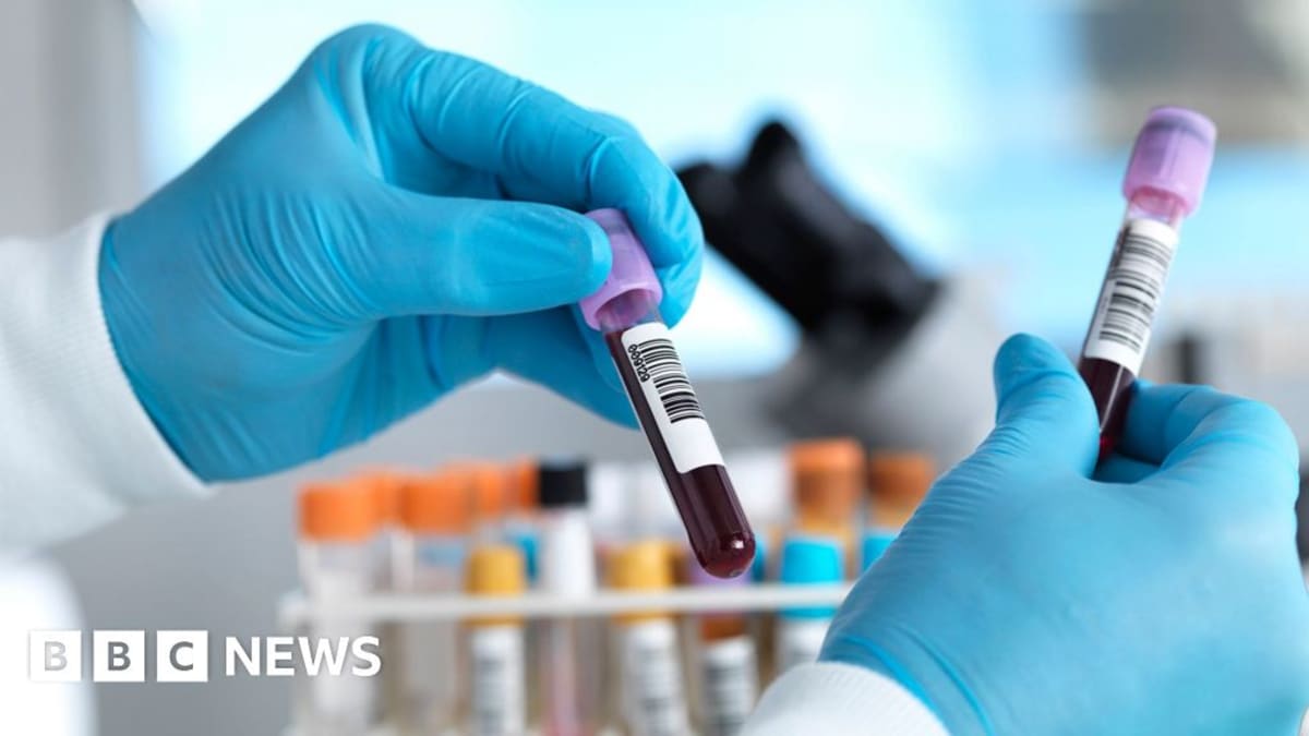 Medical professional holds hepatitis C testing kit, representing England's successful elimination campaign