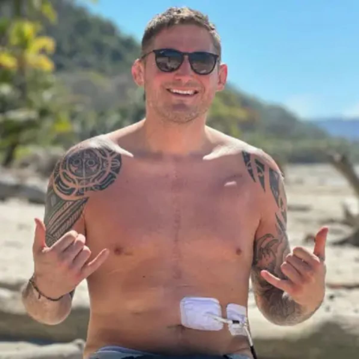 Rugby Star Holds His Own Heart After Life-Saving Transplant - Image 4