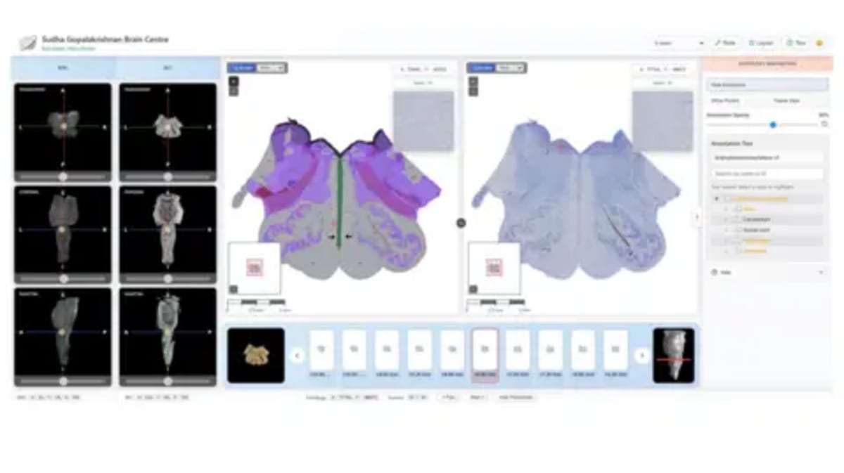 Indian Scientists Map Human Brainstem in 3D at Cellular Level - Image 4