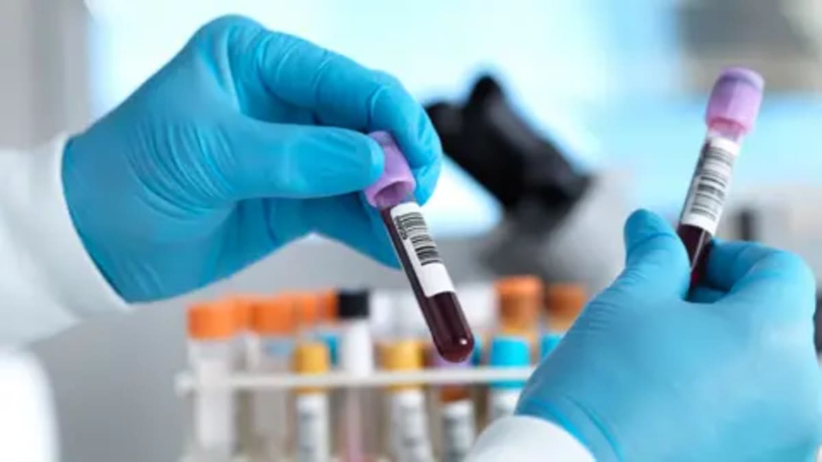 England on Track to Eliminate Hepatitis C by 2030 - Image 2