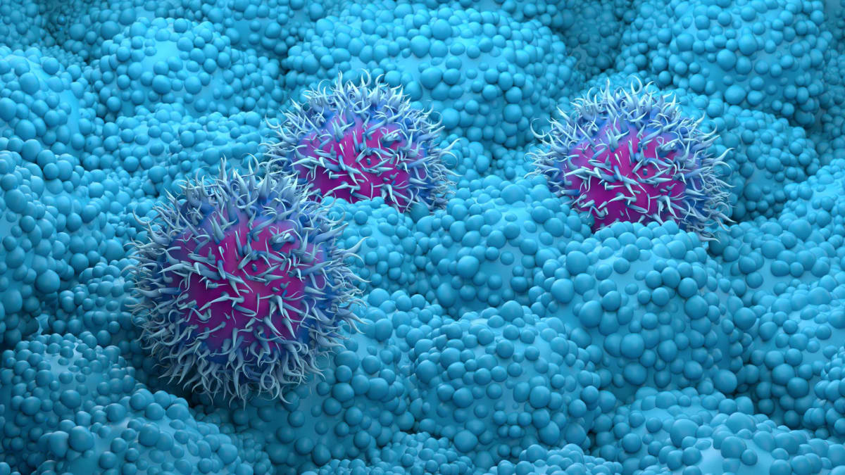 New Pancreatic Cancer Drug Doubles Survival Time in Trial