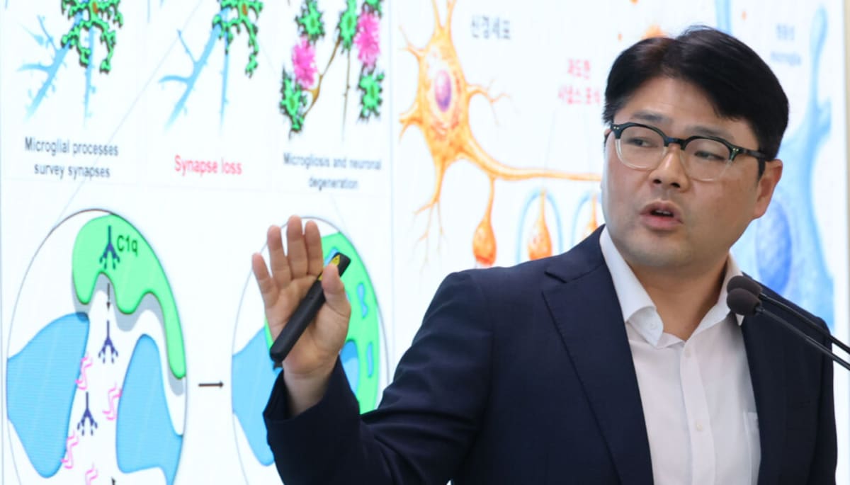 Korean Researchers Find Protein That May Reverse Alzheimer's - Image 3