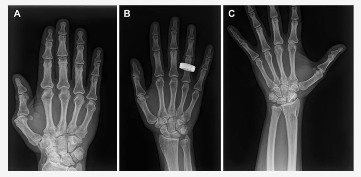 First X-rays Taken in Space Could Transform Rural Care - Image 3