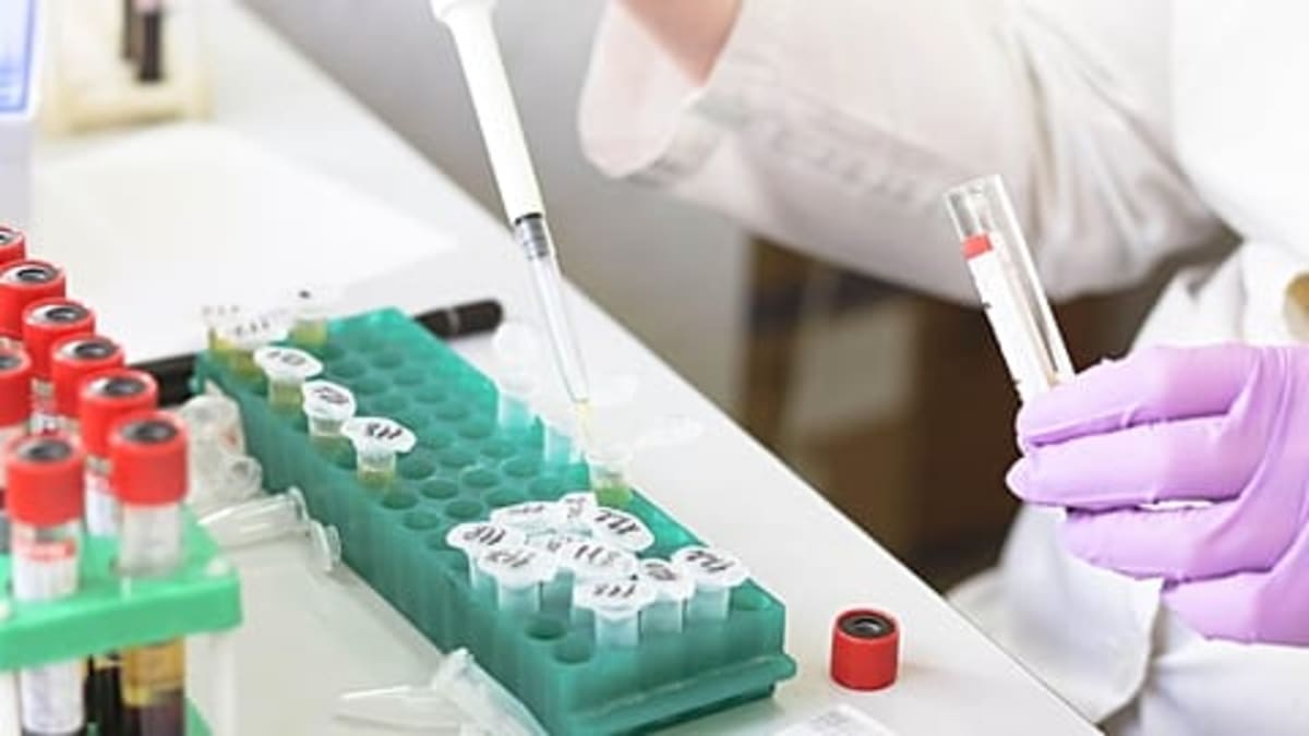 Spain Sees Record 49% Rise in Charitable Wills for Cancer - Image 4