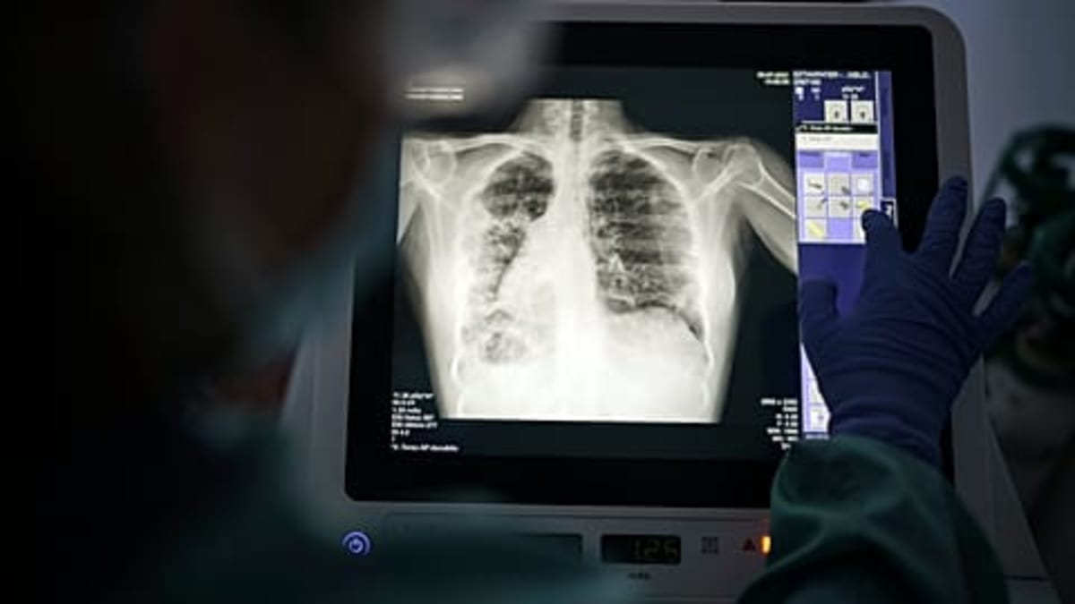 Vatican Approves Animal Organ Transplants for Catholics - Image 4