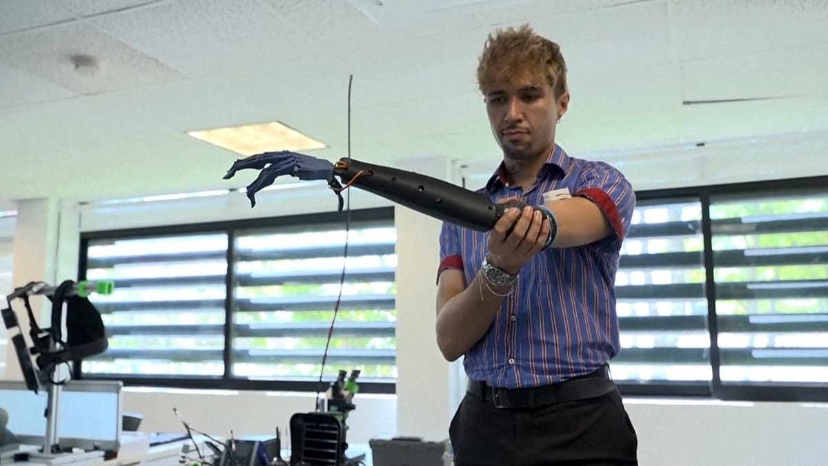 Mexico Researchers Create Simple One-Sensor Prosthetic Arm - Image 2