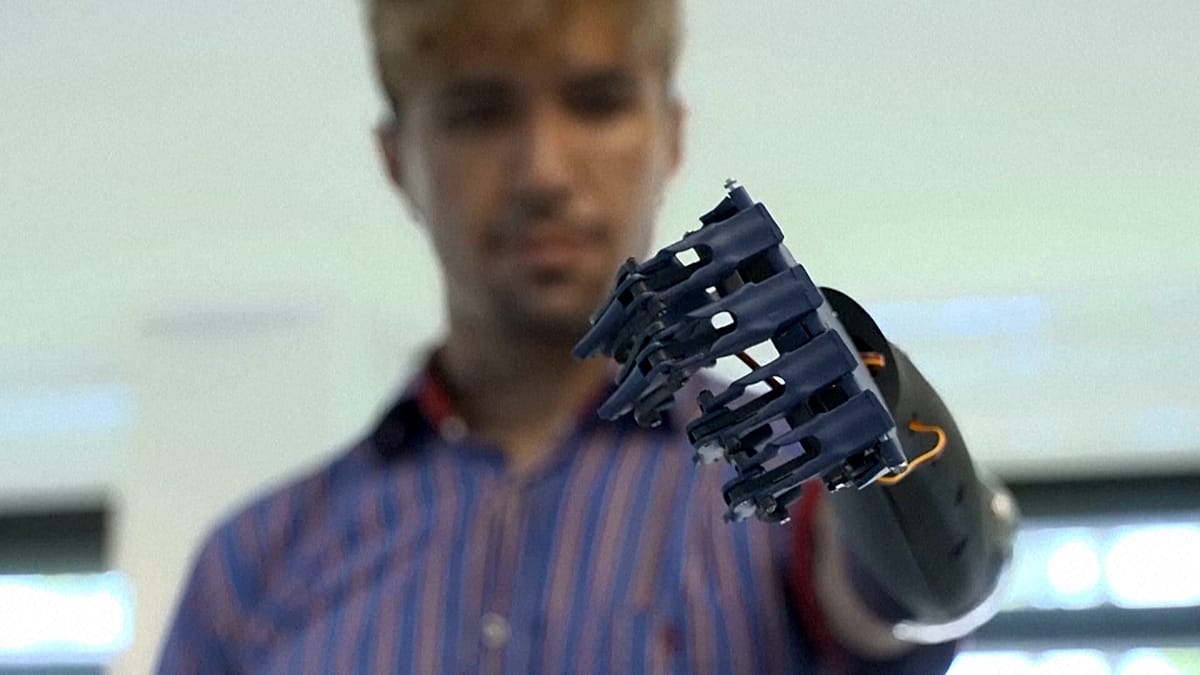 Man wearing simplified E-Redi robotic prosthetic arm developed by childhood friend in Mexico