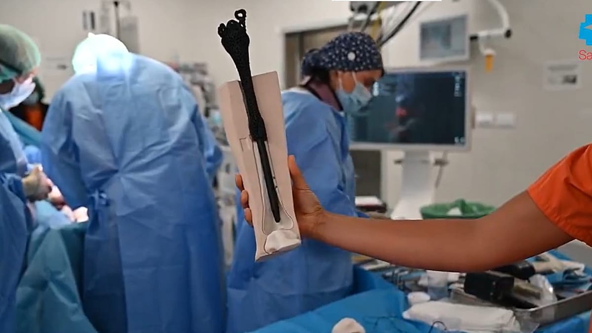 Madrid Hospital's 3D Bone Saves Man's Leg From Amputation