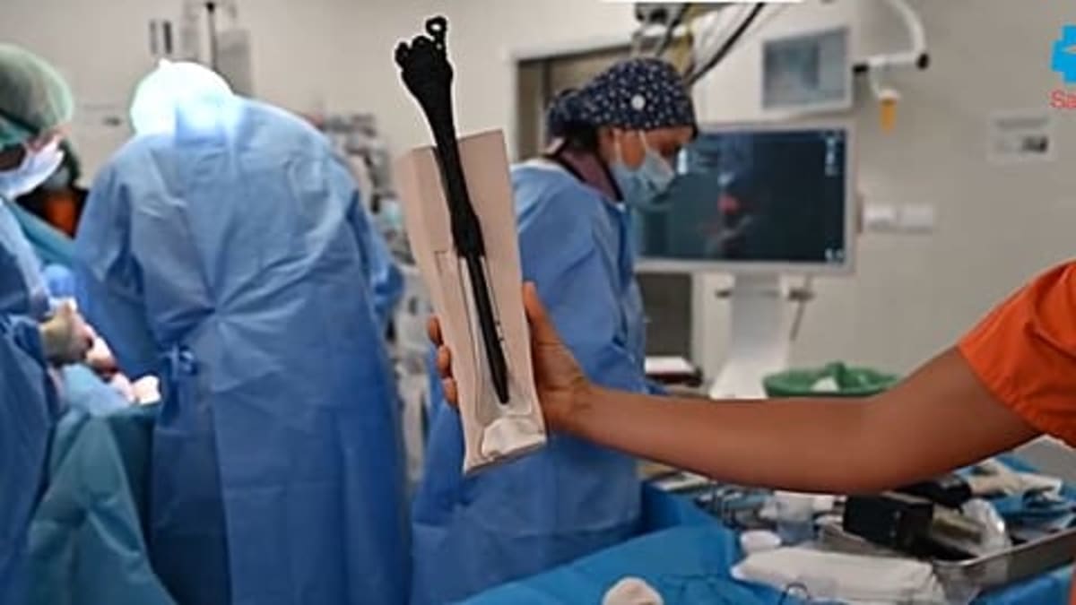Madrid Hospital's 3D Bone Saves Man's Leg From Amputation - Image 4