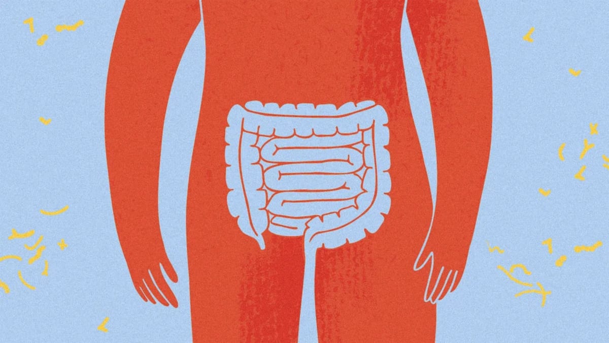 Scientists Find Clue to Rising Cancer Rates in Young Adults