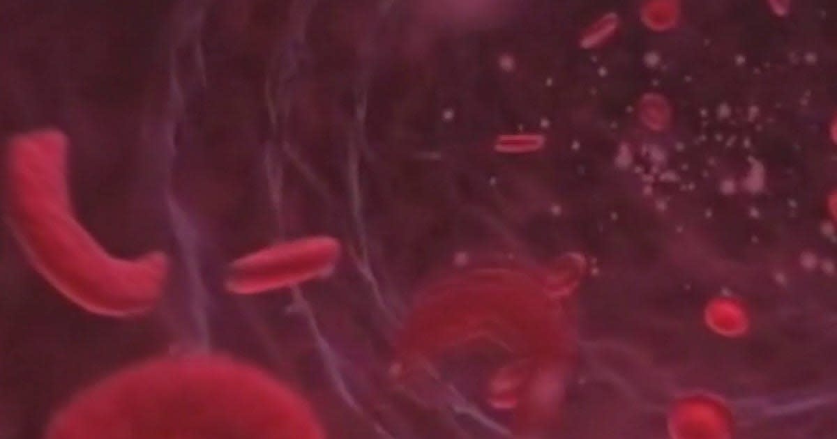 Young Black man smiling in hospital setting after receiving groundbreaking sickle cell gene therapy treatment