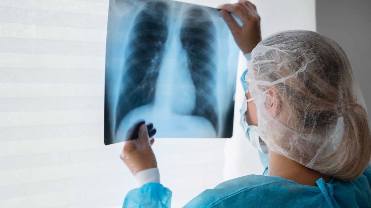 India Screens 158,000 Villages for TB With AI X-Ray Tech