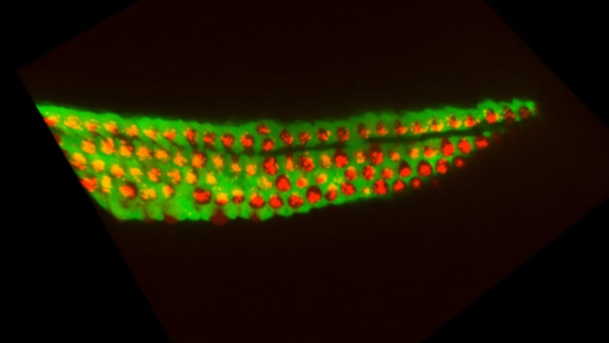 Israeli Scientists Find Way to Reverse Hearing Loss