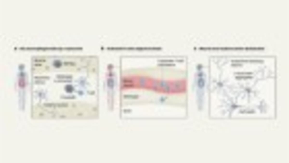 Brain's Cleaning Cells May Hold Key to Alzheimer's - Image 5