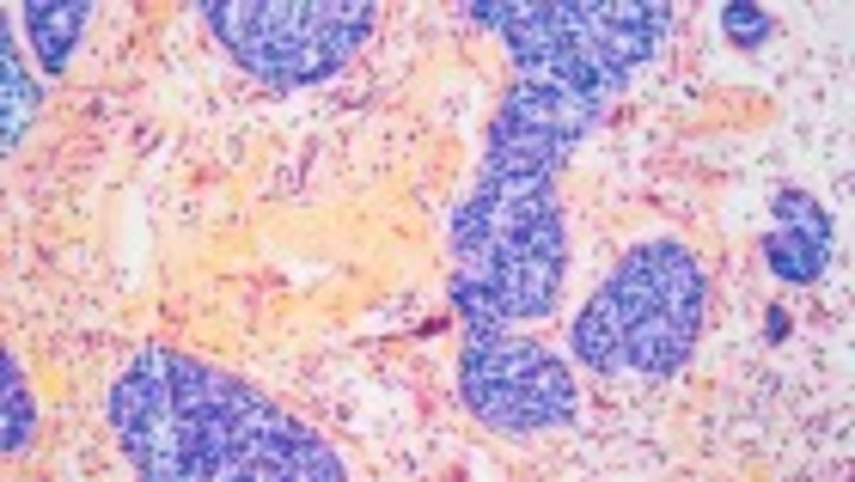 Obesity Drugs Cut Addiction Deaths by 50% in VA Study - Image 2