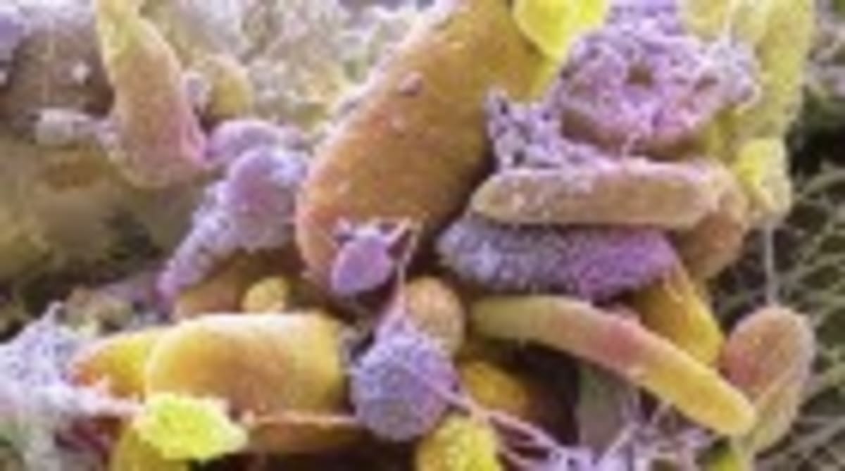 Smartwatches Now Detect Diabetes Risk Years Early - Image 2