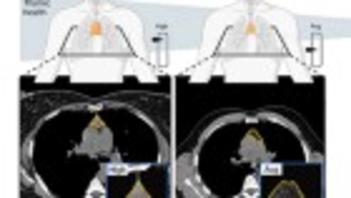 Scientists Cloak Mitochondria to Treat Deadly Disease in Mice - Image 5