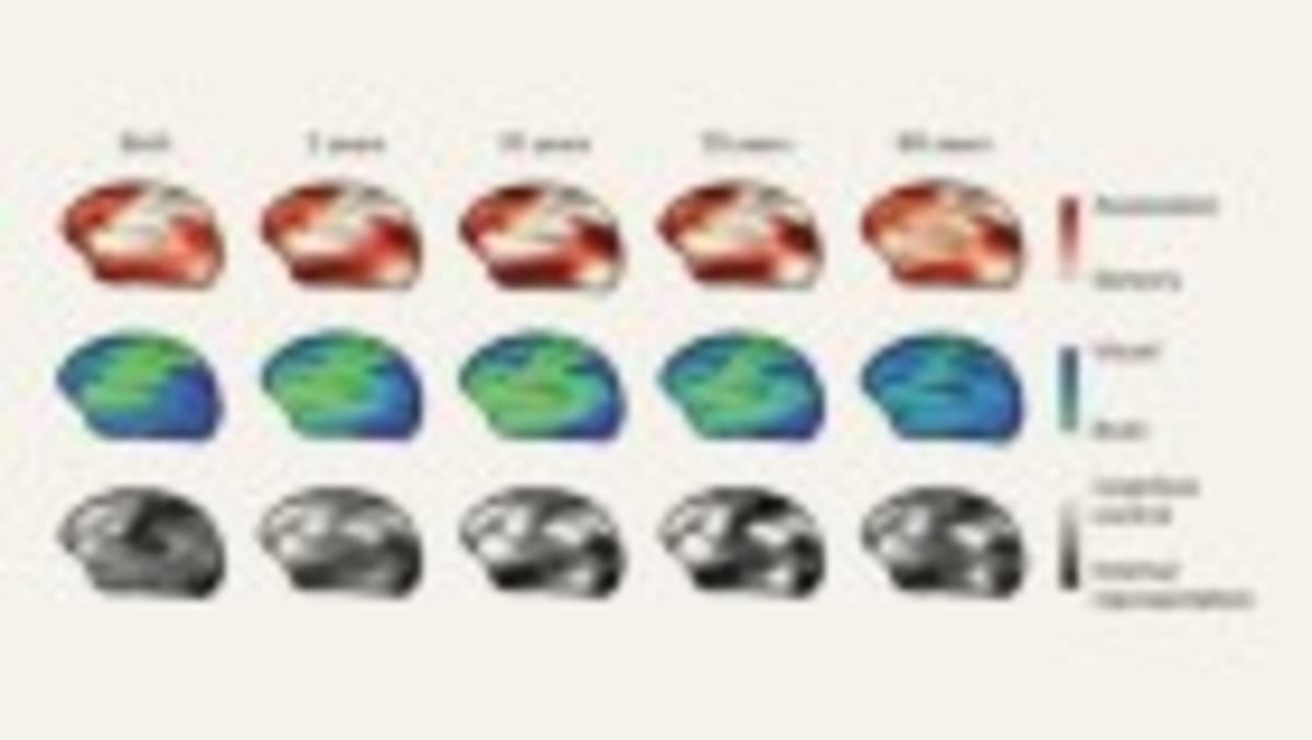 5 Psychedelics Show Similar Brain Patterns in 500+ Scans - Image 4