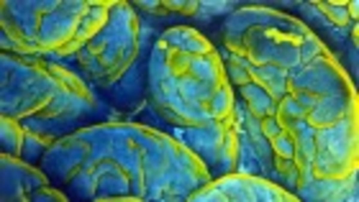 China Approves World's First Brain Chip for Paralysis - Image 2