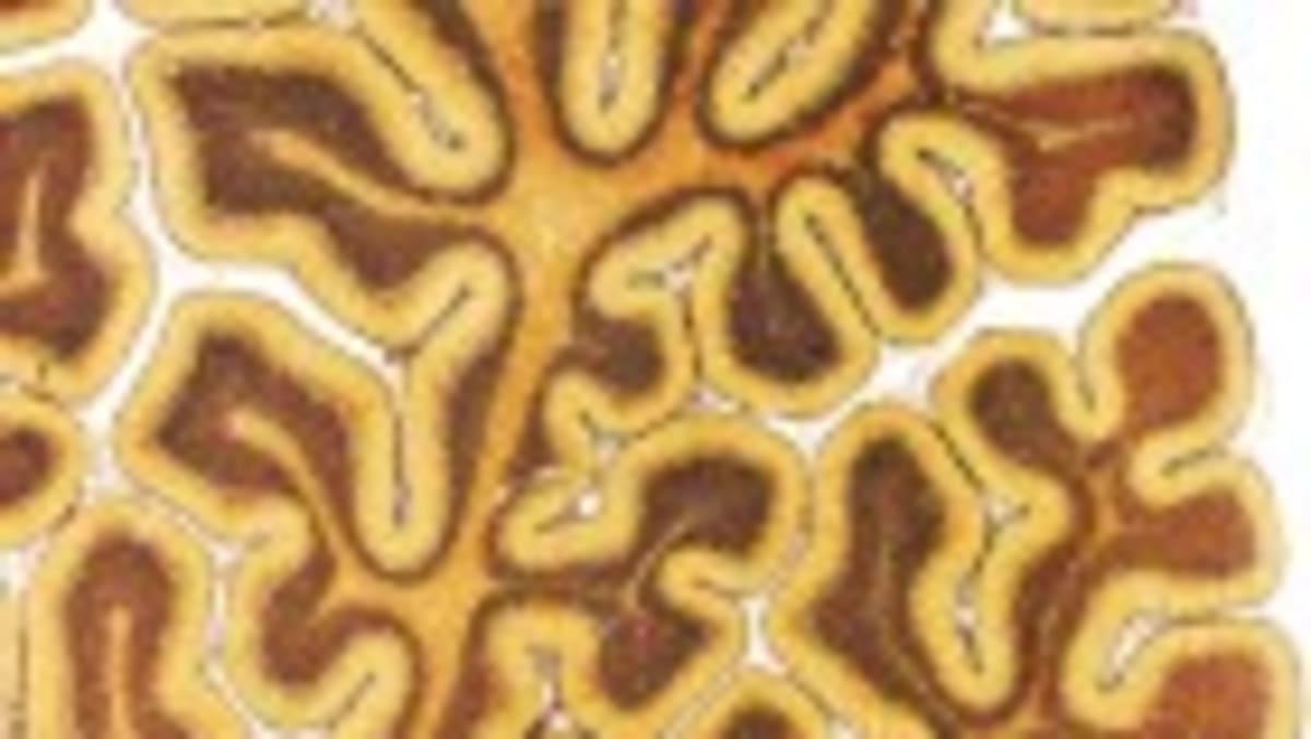 Lab-Grown Mini Brains Unlock Secrets of Human Development - Image 5